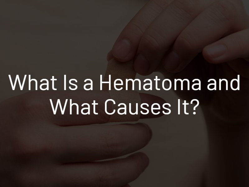 hematoma