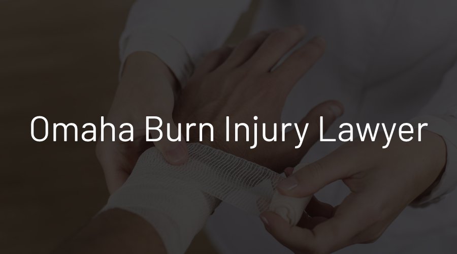 Omaha Burn Injury Lawyer