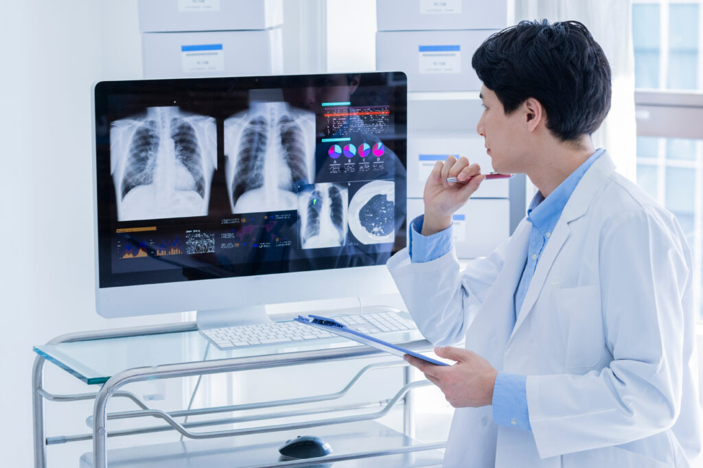 A young male doctor in a white lab coat is deeply focused while reviewing a patient's chest X ray and analytical graphs displayed on a computer monitor. He is holding a blue clipboard and a pen, worki